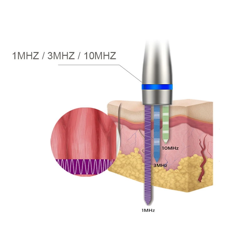 LDM Noblesse 10MHz thérapie par ultrasons 3 en 1 rides ultrasoniques supprimer beauté minceur appareil Instrument de soin du visage